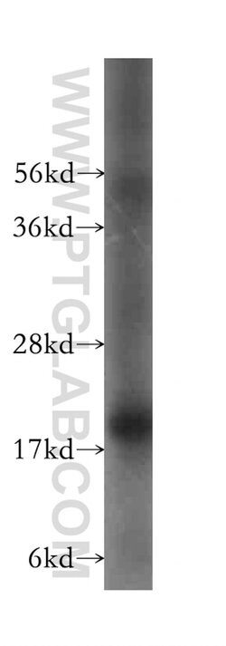 UXT Rabbit anti-Human, Mouse, Rat, Polyclonal, Proteintech 150 &mu;L; Unconjugated:Antibodies,