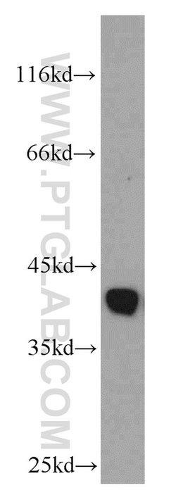 GSNOR/ADH5 Rabbit anti-Human, Mouse, Rat, Polyclonal, Proteintech:Antibodies:Primary