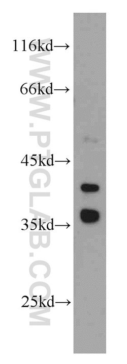 GSNOR/ADH5 Rabbit anti-Human, Mouse, Rat, Polyclonal, Proteintech:Antibodies:Primary