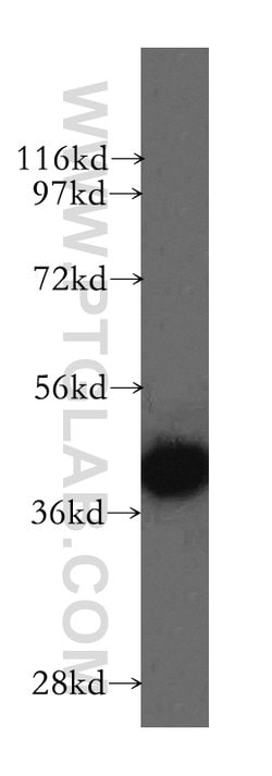 GSNOR/ADH5 Rabbit anti-Human, Mouse, Rat, Polyclonal, Proteintech:Antibodies:Primary