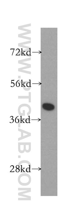 GSNOR/ADH5 Rabbit anti-Human, Mouse, Rat, Polyclonal, Proteintech:Antibodies:Primary