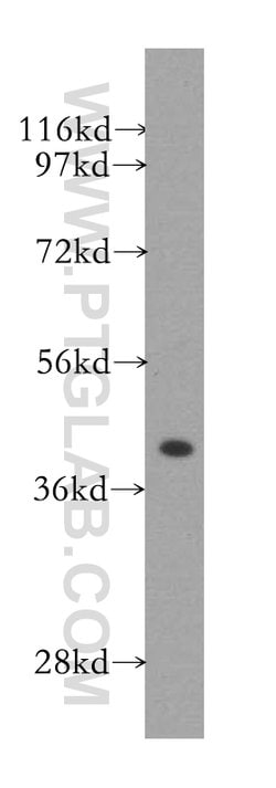 GSNOR/ADH5 Rabbit anti-Human, Mouse, Rat, Polyclonal, Proteintech:Antibodies:Primary
