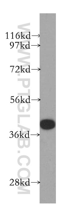 GSNOR/ADH5 Rabbit anti-Human, Mouse, Rat, Polyclonal, Proteintech:Antibodies:Primary