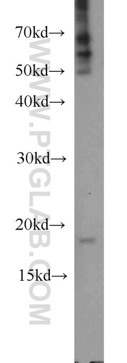 TIMM17B Rabbit anti-Human, Mouse, Rat, Polyclonal, Proteintech 150 &mu;L;