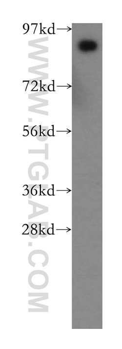 PROX1 Rabbit anti-Human, Mouse, Rat, Polyclonal, Proteintech 150 &mu;L;