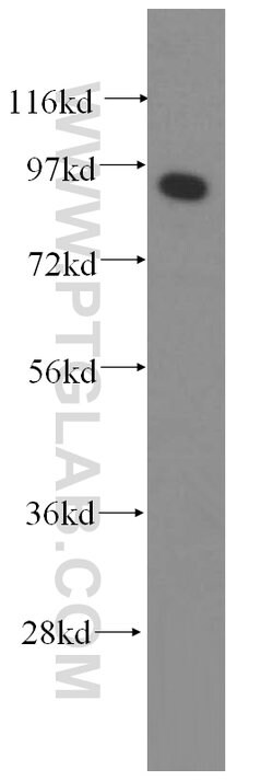 PROX1 Rabbit anti-Human, Mouse, Rat, Polyclonal, Proteintech 150 &mu;L;