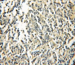 GIMAP5 Rabbit anti-Human, Polyclonal, Proteintech:Antibodies:Primary Antibodies