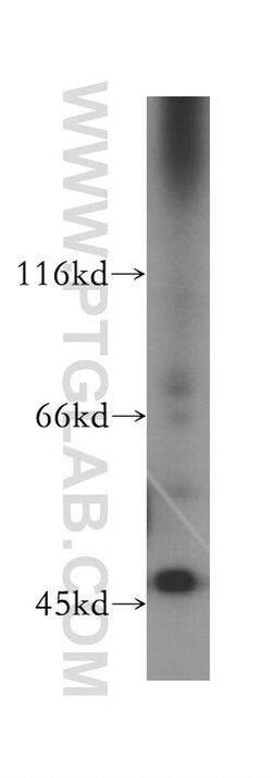 GIMAP5 Rabbit anti-Human, Polyclonal, Proteintech:Antibodies:Primary Antibodies