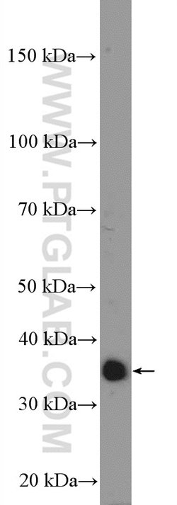 GIMAP5 Rabbit anti-Human, Polyclonal, Proteintech:Antibodies:Primary Antibodies