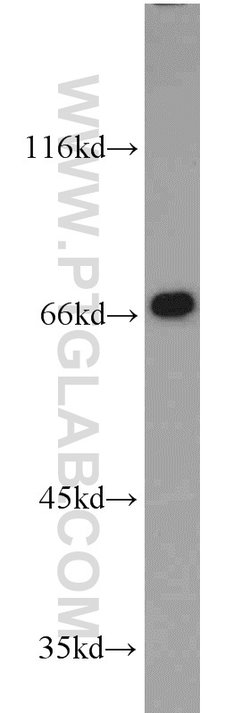 FMR1NB Rabbit anti-Human, Polyclonal, Proteintech 20 &mu;L | Buy Online | Proteintech | Fisher Scientific