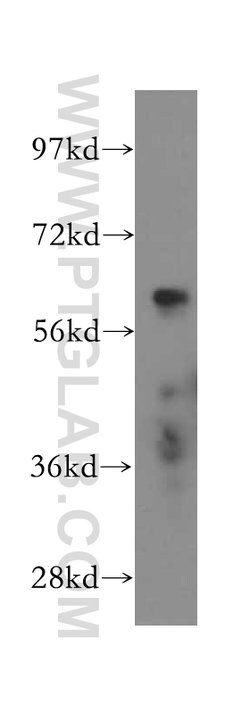 CXCR4 Rabbit anti-Human, Mouse, Rat, Polyclonal, Proteintech 20 &mu;L;