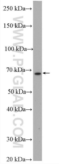 CXCR4 Rabbit anti-Human, Mouse, Rat, Polyclonal, Proteintech 20 &mu;L;