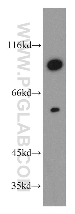 SLCO6A1 Rabbit anti-Human, Mouse, Polyclonal, Proteintech 150 &mu;L; Unconjugated:Antibodies,