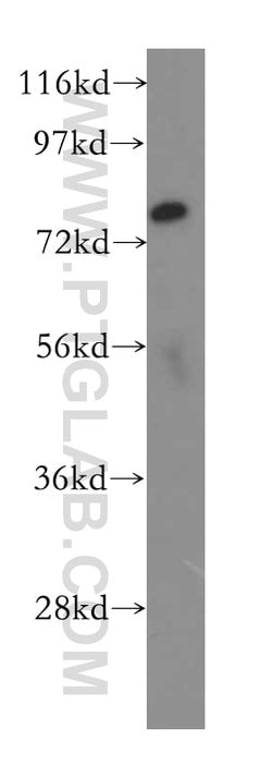 SLCO6A1 Rabbit anti-Human, Mouse, Polyclonal, Proteintech 150 &mu;L; Unconjugated:Antibodies,