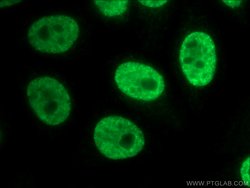 POLR3K Rabbit anti-Human, Mouse, Rat, Polyclonal, Proteintech:Antibodies:Primary