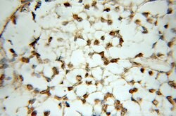 POLR3K Rabbit anti-Human, Mouse, Rat, Polyclonal, Proteintech:Antibodies:Primary