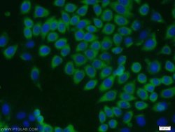 NME1 Rabbit anti-Human, Mouse, Rat, Polyclonal, Proteintech:Antibodies:Primary