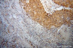NME1 Rabbit anti-Human, Mouse, Rat, Polyclonal, Proteintech:Antibodies:Primary