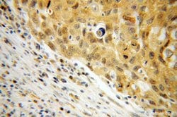 NME1 Rabbit anti-Human, Mouse, Rat, Polyclonal, Proteintech:Antibodies:Primary