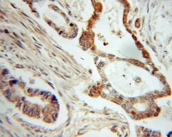 NME1 Rabbit anti-Human, Mouse, Rat, Polyclonal, Proteintech:Antibodies:Primary