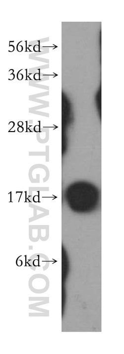 NME1 Rabbit anti-Human, Mouse, Rat, Polyclonal, Proteintech:Antibodies:Primary
