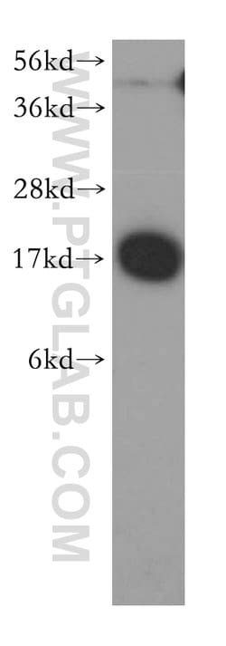 NME1 Rabbit anti-Human, Mouse, Rat, Polyclonal, Proteintech:Antibodies:Primary