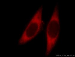 EMAP II Rabbit anti-Human, Mouse, Rat, Polyclonal, Proteintech:Antibodies:Primary