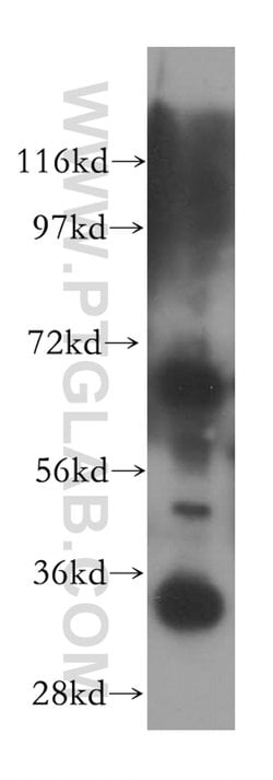 EMAP II Rabbit anti-Human, Mouse, Rat, Polyclonal, Proteintech:Antibodies:Primary