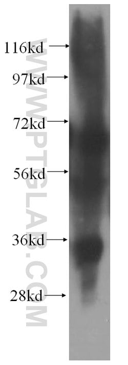 EMAP II Rabbit anti-Human, Mouse, Rat, Polyclonal, Proteintech:Antibodies:Primary