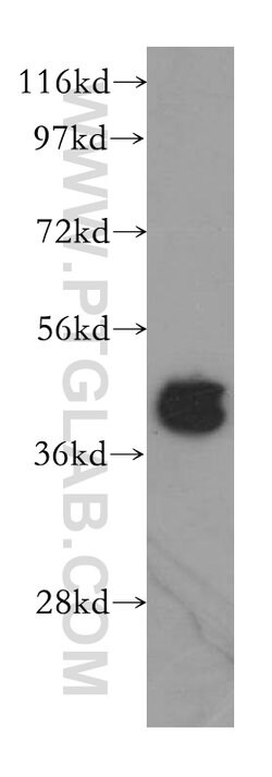 CCDC5 Rabbit anti-Human, Mouse, Rat, Polyclonal, Proteintech 150 &mu;L;
