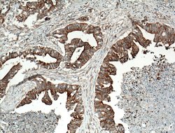 CCDC5 Rabbit anti-Human, Mouse, Rat, Polyclonal, Proteintech 150 &mu;L;