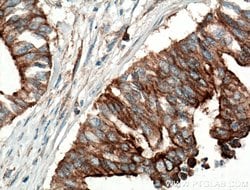 CCDC5 Rabbit anti-Human, Mouse, Rat, Polyclonal, Proteintech 150 &mu;L;