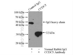 CCDC5 Rabbit anti-Human, Mouse, Rat, Polyclonal, Proteintech 150 &mu;L;