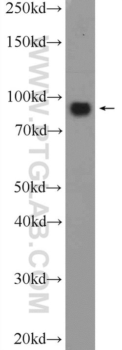 OSBP Rabbit anti-Human, Mouse, Rat, Polyclonal, Proteintech 150 &mu;L;