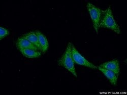 FGFR4 Rabbit anti-Human, Mouse, Rat, Polyclonal, Proteintech:Antibodies:Primary