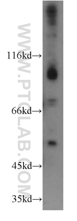 FGFR4 Rabbit anti-Human, Mouse, Rat, Polyclonal, Proteintech:Antibodies:Primary