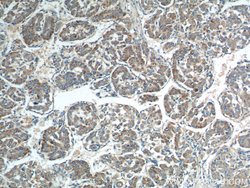 Rab23 Rabbit anti-Human, Mouse, Rat, Polyclonal, Proteintech:Antibodies:Primary