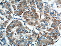 Rab23 Rabbit anti-Human, Mouse, Rat, Polyclonal, Proteintech:Antibodies:Primary