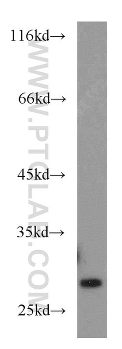 Rab23 Rabbit anti-Human, Mouse, Rat, Polyclonal, Proteintech:Antibodies:Primary
