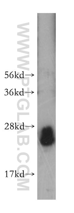 Rab23 Rabbit anti-Human, Mouse, Rat, Polyclonal, Proteintech:Antibodies:Primary