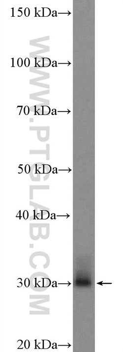 Rab23 Rabbit anti-Human, Mouse, Rat, Polyclonal, Proteintech:Antibodies:Primary