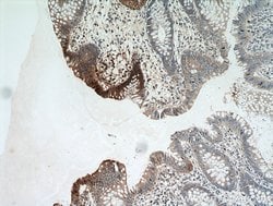 CYLD Rabbit anti-Human, Mouse, Rat, Polyclonal, Proteintech 150 &mu;L;