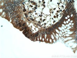 CYLD Rabbit anti-Human, Mouse, Rat, Polyclonal, Proteintech 150 &mu;L;