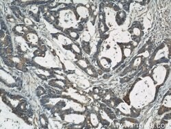 CYLD Rabbit anti-Human, Mouse, Rat, Polyclonal, Proteintech 150 &mu;L;