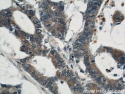 CYLD Rabbit anti-Human, Mouse, Rat, Polyclonal, Proteintech 150 &mu;L;