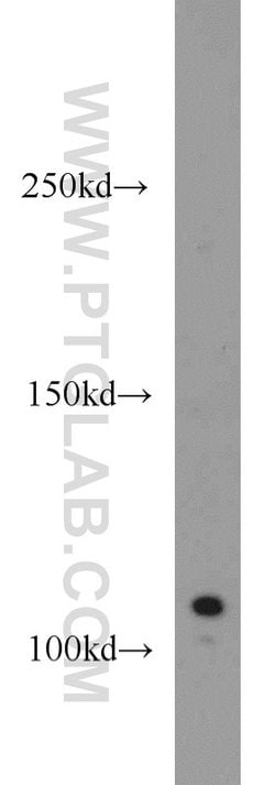 CYLD Rabbit anti-Human, Mouse, Rat, Polyclonal, Proteintech 150 &mu;L;