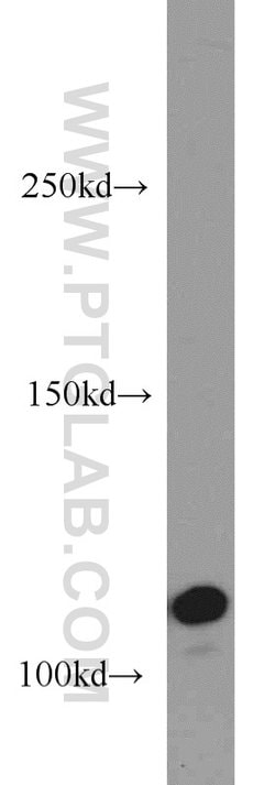 CYLD Rabbit anti-Human, Mouse, Rat, Polyclonal, Proteintech 150 &mu;L;
