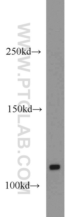 CYLD Rabbit anti-Human, Mouse, Rat, Polyclonal, Proteintech 150 &mu;L;