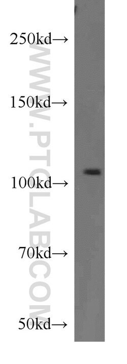 CYLD Rabbit anti-Human, Mouse, Rat, Polyclonal, Proteintech 150 &mu;L;