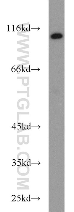 CYLD Rabbit anti-Human, Mouse, Rat, Polyclonal, Proteintech 150 &mu;L;
